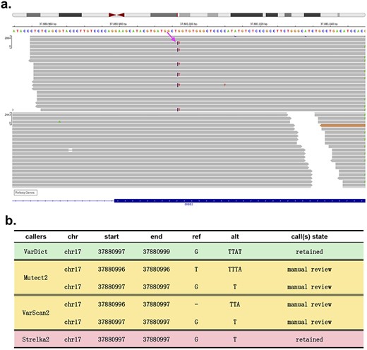 A complex multinucleotide variant at chr17:37880997 in the human reference genome hg19. (A) Integrative Genomics Viewer (IGV) screenshot of reads covering the variant. Each read is represented by a grey bar. The purple vertical lines on reads represent insertion events, and the different bases are coloured. For example, the red ‘T’ represents a single-nucleotide variant (SNV) from G to T. (B) Calls of VarDict, Mutect2, VarScan2 and Strelka2.