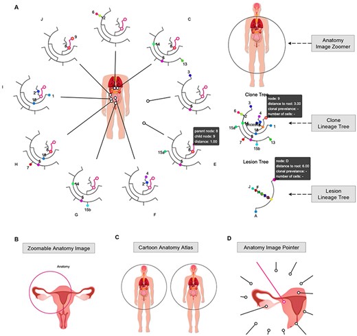 Space Lineage interface (https://sc.deepomics.org/oviz-project/analyses/space_lineage). (A) The full display of Space Lineage on demo data A21. In the left panel, clonal lineage trees from multiple lesions surround a zoomable anatomical image, and each lineage tree is equipped with an image pointer referring to the exact location of the anatomical image. The right panel has the anatomy image zoomer, clone lineage tree and lesion lineage tree from top to bottom. This demo figure shows that 16 tumor clumps were detected in nine primary and metastasis lesions from a prostate cancer patient. The clonal lineage tree suggests that through tumor evolution and metastasis, subclones are scattered in different lesions. When the mouse cursor hovers over one Oviz object (e.g. the lineage tree branch link to clones 8 and 9), associated Oviz objects will be highlighted, and tooltips with essential information will appear. (B) The display of zoomable anatomy image. Users can right click the image circle to active and deactivate it. Users can drag the circle to anywhere they want in the anatomy image to make the left/right position adjustments when the image circle is activated. Users can also adjust the radius of the anatomy image for zooming. (C) Demonstration of cartoon anatomy atlas. Users can select different anatomy images from the license-free cartoon anatomy atlas (male, female, brain, intestines, kidney, liver, lung, pancreas, stomach, thymus, thyroid, urinary system, male reproductive system and female reproductive system). Freepik and macrovector/Freepik design the cartoon anatomy images, we acknowledge for the free license. (D) The display of anatomy image pointer. Users can right click to active the anatomy image pointer and drag it to the exact lesion position.