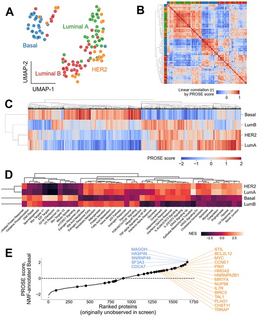 PROSE supports recovery of known and novel, putative disease-linked proteins that are undetected in the initial proteomic screen. PROSE scoring was applied to the CPTAC breast cancer TMT dataset by Krug et al. (2020) and used to predict regulatory programs and missing proteins. (A, B) UMAP projection and heatmap demonstrating clustering of breast cancer subtypes by their inferred NMF label from the original dataset. HER2-positive breast cancer represents a particularly heterogenous population. (C) Mean PROSE scores of the top 5000 highest-variance proteins. The 2357 proteins with high-variance PROSE scores that were undetected in the initial proteomic screen are annotated above as black ticks. (D) GSEA using the above 5000 proteins, using MSigDB_Hallmark_2020 annotations, retaining well-established signatures for each subtype. (E) Mean PROSE scores of undetected genes with putative driver roles in the Basal-like/triple-negative (TN) subtype. Example annotated oncogenes are shown in orange (right) and are represented by larger dots. Example genes without annotated roles in cancer are shown in blue (left).