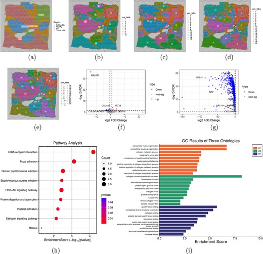 Decipher the progressive lesion area of breast cancer. (a) Visualization of four morphologies included in the manually annotated 20 domains. (b-e) Visualizations of spatial domains identified by TGR-NMF on the first HBRC dataset when the number of spatial domains is set to 10, 15, 20, and 25, respectively. (f) Volcano plot of DEGs between the absolute healthy region and the progressive lesion area. (g) Volcano plot of DEGs between the progressive lesion area and its surrounding cancerous regions. (h) Bubble plot of KEGG pathway analysis. The larger the bubble, the more genes are involved, and the redder the color, the more significant the enrichment. (i) Enrichment analysis results of BP, CC, and MF.