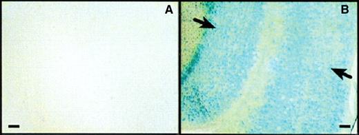 Active Tat-β-Gal was successfully transduced across the blood–brain barrier. The X-Gal staining of brain sections from mice 8 h after intraperitoneal injection with (A) control β-Gal or (B) Tat-β-Gal. β-Gal activity was localized to the cell nuclei indicated by the arrows. Source: Taken from Schwarze et al.41