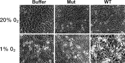 CPP-ODD mediated delivery of pro-apoptotic protein Caspase 3 in normal (20% O2) and hypoxic (1% O2) conditions. Mouse 3T3 cells were treated with buffer, mutant Tat-ODD-Caspase 3 or wild-type (functional) Tat-ODD-Caspase 3 for 24 h. Tat-ODD-Caspase 3 was administered as a fusion protein by intraperitoneal injection. Apoptotic features are clearly visible only in hypoxic cells after treatment with functional Tat-ODD-Caspase 3. Source: Taken from Harada et al.49
