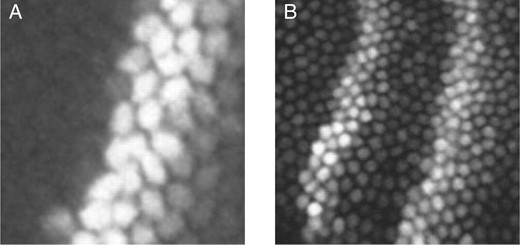 Close-up views of two embryos. (A) Embryo ba3, showing spatial discontinuity in expression of even-skipped, which is fully off in some nuclei and fully on in some adjacent nuclei. (B) Embryo FEScc34, showing significant variability of expression of even-skipped, even within a single stripe.