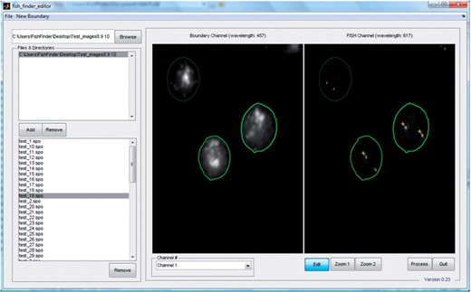 FISH Finder editor window showing results from the segmentation process. Segmented nuclei containing two identified FISH signals are outlined in bright green, segmented nuclei containing only one identified signal are outlined in light green and segmented nuclei with no identified signals are outlined in dark green. Signals can be added or removed by selecting the Edit button and then selecting the point of interest on the image using the right mouse click button (signals identified by FISH Finder are labeled by a yellow cross-hair; signals marked by an investigator in FISH Finder's editing screen are labeled by a blue cross-hair). Segmented nuclei can be removed by clicking the middle mouse click anywhere inside the boundary.