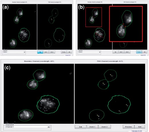FISH Finder's nuclei division function. (a) Results of automated analysis show the segmented boundaries of two nuclei adjoined. (b) The nuclei division function allows users to select two neutral points between adjoined nuclei to be divided. Division points are determined by first selecting the edit button at the bottom of the Editor screen, and then points are chosen by the user on the image itself using the left mouse click button. (Enlarged image shows the two points selected for division as two red crosshairs.) (c) Results of the nuclei division function showing adjoined nuclei divided as two separate nuclear boundaries (left, DAPI; right, FISH signals).