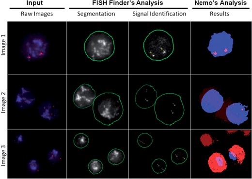 Comparison of results with three types of typical images obtained in FISH experiments. Shown are the raw (.dv) images, FISH Finder's unedited results of segmentation and signal identification, and Nemo's results of segmentation and signal identification. Image 1 demonstrates FISH Finder's accurate boundary segmentation and signal identification compared with Nemo's underestimation of the nuclear boundary with nonetheless accurate signal identification. Results of analysis for Image 2 demonstrate failure of nuclei segmentation and signal identification for both programs; showing over- and underestimation of a nuclear boundary and failure to identify one of four signals by FISH Finder and underestimation of nuclear boundaries and failure to identify all signals by Nemo. Image 3 shows FISH Finder's accurate nuclei segmentation and signal identification compared with Nemo's results of inaccurate segmentation and false-positive FISH signal identification.