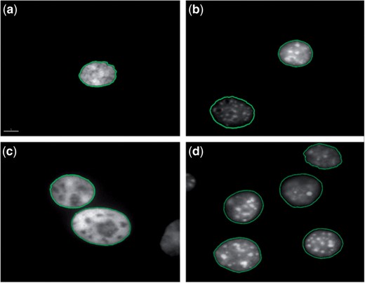 Segmentation of (a) 2D-fixed human ALL nucleus. (b) 2D-fixed Mouse C127 nucleus. (c) 2D-fixed CHO nuclei. (d) 3D-fixed mouse ESC nuclei.