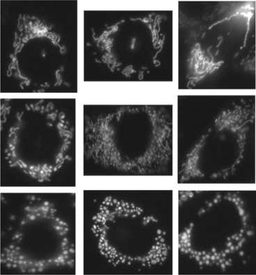 Example cell images show different fragmentation stages of mitochondria, tagged with a fluorescent dye. Images at the bottom row are cells with the completely fragmented mitochondria, at the top row are those without fragmentation, those in the middle are partially fragmented. From (Lin et al., 2010)