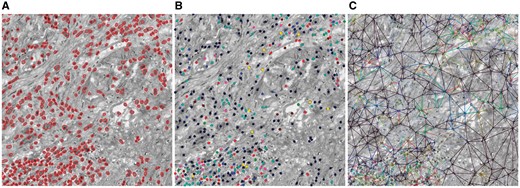 Illustration of the three main steps involved in our feature extraction workflow. (A) Nucleus segmentation. (B) Nucleus pattern learning using stacked sparse autoencoder to learn high-level features followed by clustering. Nucleus patterns are indicated by different colors. There are eight nucleus patterns. (C) Delaunay triangle edge patterns showed in different colors. Edge patterns are defined in terms of their end nodes. There are 36 edge patterns since we have eight nucleus patterns. The H&E image is converted to a grayscale image to highlight colors (Color version of this figure is available at Bioinformatics online.)
