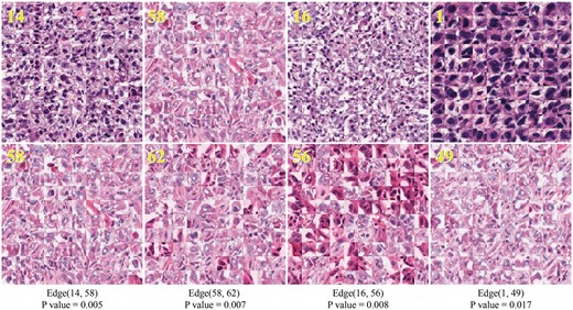 Examples of the learned nucleus patterns forming edge types that are strongly associated with survival. The number of nucleus clusters is set to 64. The number in the upper-left corner of each image is the cluster index. Each image consists of 10 × 10 nucleus patches from the same cluster (Color version of this figure is available at Bioinformatics online.)