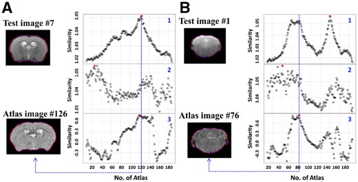 Examples of texture and shape feature curves. (A) (1) The scaled global texture similarities, (2) The unscaled global texture similarities, (3). The shape similarities between the seventh image (up) in the query sequence and all the images in the atlas image set 1. The red triangle indicates the location of the maximum on each curve. Atlas #126 (bottom) is the best matched image in the atlas image set. (B) (1) The scaled global texture similarities, (2) The unscaled global texture similarities, (3) The shape similarities between the first image (up) in the query sequence and all the images in the atlas image set 1. Atlas #76 (bottom) is the best matched image in the atlas image set