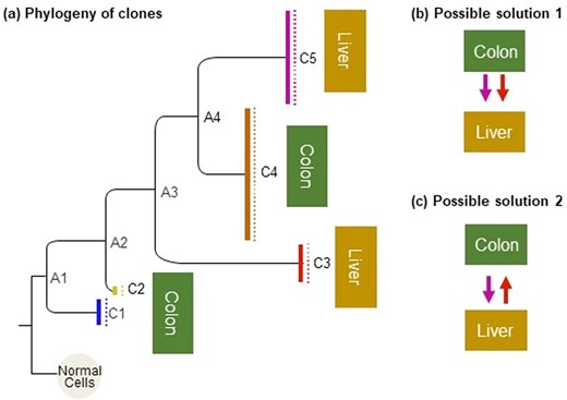 (a) A phylogeny of cancer cells in a metastatic colorectal cancer patient (CRC2 patient); see Zafar et al. (2019). Cancer cells with the same genotype comprise clones (C1–C5), and the lengths of branches are proportional to the number of sequence differences between clones. The phylogeny is rooted on the germline sequence, which represents a healthy and not-mutated cell sequence (normal). Here, the primary tumor was found in the colon and contained three clones (C1, C2 and C4), whereas the metastatic tumor occurred in the liver and contained two clones (C3 and C5). In addition to the presence of five clones in this patient, this phylogeny shows that at least four other clones existed (ancestral clones, A1–A4). (b) Migration history in which two different clones from the colon, together or at different times, migrated to the liver and seeded metastases. This solution was inferred by Leung et al. (2017) and, further supported by Zafar et al. (2019) who applied the MACHINA approach (El-Kebir et al., 2018). (c) An alternative migration history in which clones travelled from colon to liver, but also from liver to colon, after the formation of the metastasis from clones from the primary tumor. This migration history was inferred by MACHINA when the number of tumor sources of seed clones was not constrained (El-Kebir et al., 2018)
