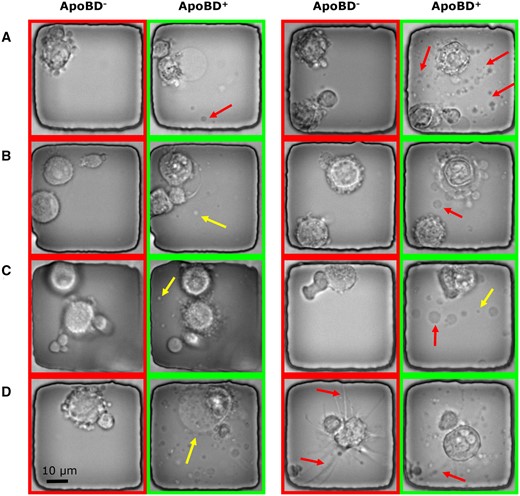 Sample images illustrating the variations in the appearance and complexity of ApoBDs and apoptotic cells in phase-contrast images. Nanowells labeled with ApoBD- do not contain ApoBDs, whereas those labeled with ApoBD+ do. (A) An apoptotic cell can release a variable number of ApoBDs (the arrows point out some examples). (B) The ApoBDs are motile and variable in appearance, as exemplified by the ApoBDs indicated by the arrows. (C) Illustrating the variable sizes of ApoBDs. (D) Illustrating the cell-morphological changes that accompany the release of ApoBDs.