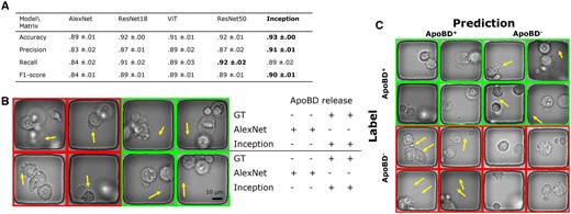 A comparison of the performance of five available deep neural networks. (A) The table showed that the Inception network performed the best in accuracy, precision, and the F-1 score. (B) We compared the AlexNet and Inception networks’ performance w.r.t. the GT. Visual examples showed that compared to the AlexNet, the Inception network successfully classified the more complex images with finer details (arrows). (C) Visual examples of Inception networks’ prediction in the format of a confusion matrix showed that despite the overwhelmingly successful performance of the Inception network, there were still rare failures due to details in images (arrows).