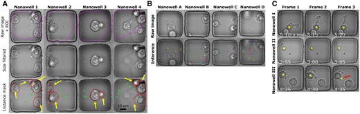 The method for identifying apoptotic cells based on the distribution of ApoBDs. (A) Illustrating the steps for automatically generating segmentations of ApoBDs and cells for four sample nanowells. First, the Resnet50 neural network delineated the RoIs as the contours. The second row shows the result of artifact elimination using size-based filtering of the objects (blobs) in the nanowells. The third row shows the results of instance segmentation with contours with arrow indicating cells and the ones without indicating ApoBDs. (B) Visual examples of effective ApoBD detection using a mask RCNN trained on the segmentations created as in (A), but when run directly on the raw, unfiltered images. (C) The associative process identified apoptotic cells and labeled them with the boxes. We used majority voting across frames to remove rare detection failures highlighted by the arrow.