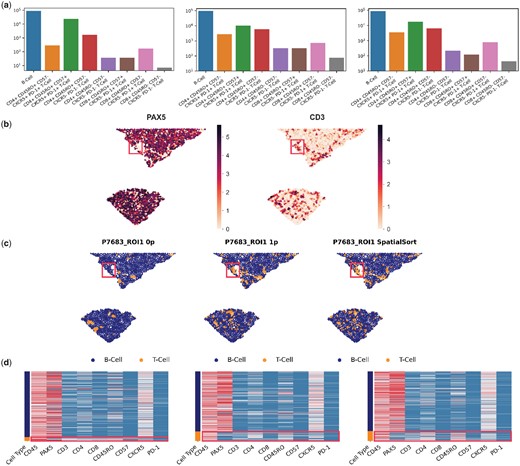 Cell type annotation of DLBCL MIBI data using SpatialSort. (a) The cell type distribution bar graph of the clustering results from using the 0p, 1p, and Kp model. Counts are log-scaled. (b) Spatial distribution of the expression of lymphocyte lineage markers, PAX5 and CD3 in sample P7683. Colour represents normalized intensity of expression. (c) Sample P7683 plotted by spatial coordinates. Cells are colour-coded by cell type assignment inferred by the 0p, 1p, and Kp models in anchor mode. The red box in b and c highlights one area of significant difference in cell assignment. (d) Sample-specific expression heatmaps for sample P7683. Rows are colour-coded by cell type shown in (c). T-cells are highlighted by red boxes to illustrate mixed PAX5 expression.
