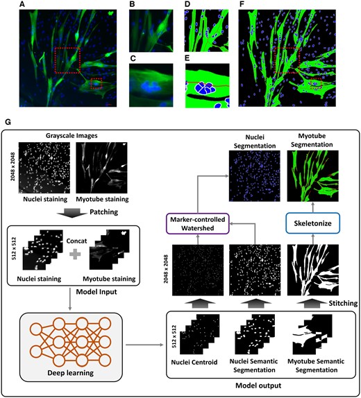 Process of performing segmentation from myotube (Myh1) and nuclei (DAPI) fluorescence images. (A) is the original fluorescence image. (B) and (C) are enlarged images of the box from image (A). (D) and (E) are images in which the box is enlarged from the (F) image generated by performing the (G) process. (G) is the process of generating the segmentation image (F) to calculate quantitative parameters of myotube through deep learning and post-processing from the original fluorescence image.