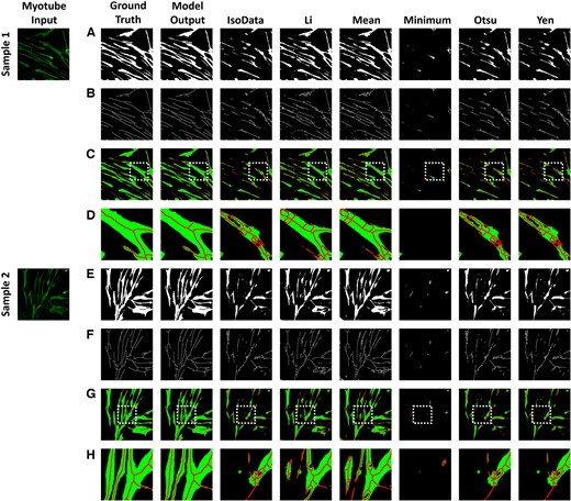 Myotube segmentation comparison of the proposed method with six threshold algorithms: IsoData, Li, Mean, Minimum, Otsu, and Yen. (A) and (E) are the results of myotube semantic segmentation, and (B) and (F) are the results of skeletonization from (A) and (E). (C) and (G) are the result of combining (A) and (B), (E) and (F). (D) and (H) are the results of enlarging the white box from (C) and (G).