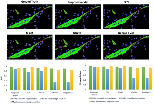 Comparison results with famous image segmentation models: FCN, U-net, UNet++, and DeepLab v3+. The result above is an image cropped from an image that underwent post-processing on the results of a deep learning model. The box graph below shows the segmentation performance results for each model.