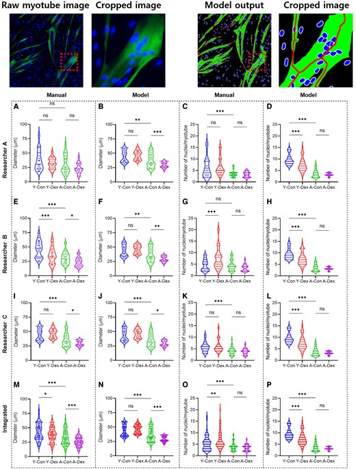 Original myotube image and model output image with cropped image. Manual and deep-learning-based morphological analyses as well as the effects of dexamethasone on young and aged skMCs. (A to P) Quantification of myotube features based on the diameter as manually assessed by researchers A−C (A, E, and I) and by model (B, F, and J) as well as nuclei as manually assessed by researchers A−C (C, G, and K) and by model (D, H, and L). (M to P) Integrated quantification results of the myotube features, both for diameter assessed manually (M) and by model (N) as well as for nuclei assessed manually (O) and by model (P). (n = 3) (*P < 0.05; **P < 0.01; ***P < 0.001; compared to young control, Y-Con; young control, Y-Dex; young with dexamethasone, A-Con; aged control, A-Dex; aged with dexamethasone).