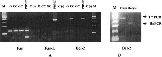 A) Ethidum-bromide-stained agarose gel showing the heminested PCR products in unfertilized oocytes (O), CC, and purifed freshly isolated granulosa cells (GC). B) Bcl-2 mRNA expression in fresh isolated oocytes