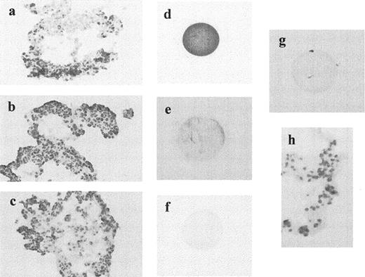Immunostaining of the Fas antigen, FasL, and bcl-2 on freshly isolated CC and unfertilized oocytes. Fas protein expression was observed on CC (a) and unfertilized oocytes (d). However, neither FasL (b, e), nor bcl-2 (c, f) were detected in both types of cells. Replacement of the primary antibodies with rabbit and/or mouse immunoglobulins showed lack of staining in oocytes and CC (g, h)