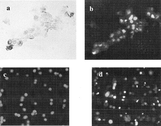 Colocalization for Fas receptor and TUNEL assay in freshly isolated CC. a) Light microscopy (×20) showing four CC, three of them positive for Fas receptor. b) Same picture showing DNA fragmentation (fluorescein isothiocyanate) by fluorescent microscopy in Fas-negative cells. Example of apoptosis in c) freshly isolated and d) 24-h cultured CC (×p20). The nuclei of the cells (red dots) are stained with PI