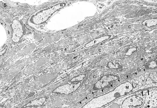 Electron micrograph of the interstitium and border of the seminiferous tubule (lower right) typically seen in feminized animals. External to the seminiferous tubule are numerous layers of fibroblast-like cells (F) with abundant intervening collagen (C). Identified is the myoid cell (M), Sertoli cell (S), and an interstitial capillary (top center). No lymphatic space was found outside the seminiferous tubule. The myoid cell appeared to be large and immature. No parietal cell of the lymphatic space was found external to the myoid cell (arrowheads show its expected position). There was no basal lamina between the myoid cell and the Sertoli cell, instead some microvillous processes were noted in one region (arrows). Magnification = ×4600.