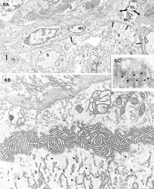 A) Low-power electron micrograph showing a seminiferous tubule and interstitial region of a feminized animal. There was no basal lamina between the myoid cell and the Sertoli cells comprising the seminiferous tubule contents. Microvillous processes (arrows) of the large, immature-appearing myoid cells (MC) commonly projected toward the Sertoli cells (S). The interstitium showed fibroblastic cells (F) and collagen accumulation (C) as well as excessive basal lamina (BL) material. B) High magnification micrograph of the relationship of the myoid cell (upper part of image) and the Sertoli cell (S) showing the absence of a basal lamina and the presence of microvillous (mv) processes primarily emanating from the myoid cell. Note that microtubules (arrowheads) were commonly seen in the basal cytoplasm of the Sertoli cell. C) Region of Sertoli-Sertoli cell junctions sectioned en face shows electron-opaque linearities (arrowheads) that represent occluding junction strands. Magnification of A = ×4600; B = ×21 000; C = ×47 000