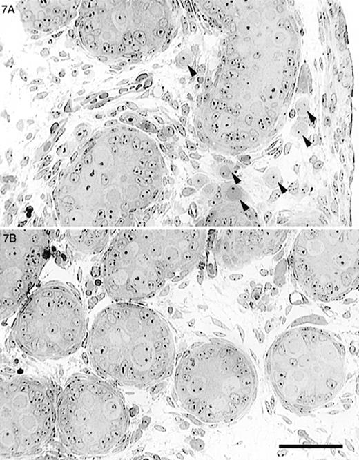 Light micrographs of testes from newborn mice. A) Newborn Dhh-null mouse showed slightly irregular seminiferous tubules and gonocytes (arrowheads) outside of the seminiferous tubules. B) Control mouse testis showed rounded tubular profiles and no extratubular gonocytes. Bar = 50 μm