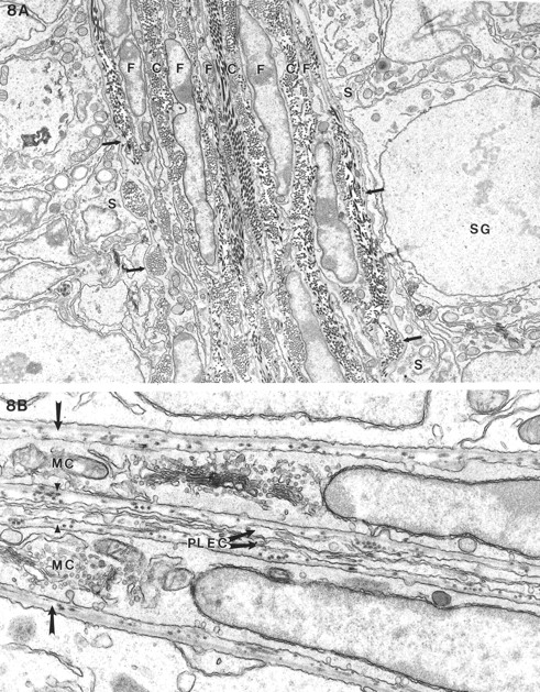Electron microscopy of seminiferous tubules and interstitial cells of feminized Dhh-null (A) and heterozygous (B) males at 20 days of age. A) Adjacent seminiferous tubules showed a thin basal lamina (arrows) abutting the Sertoli cells (S) and a spermatogonium (SG). External to the basal lamina were numerous layers of fibroblastic (F) cells with intervening collagen (C) with no evidence of a lymphatic space. B) In a heterozygous animal where two tubules adjoined, the typical basal lamina (arrow) was seen between the myoid cells (MC) and the Sertoli cells. External to the basal lamina was yet another basal lamina (arrowheads) separating the myoid cell from the parietal lymphatic endothelial cell (PLEC). Because the two tubules were closely apposed, there was no lymphatic space. Magnification of A = ×8500; B = ×4600