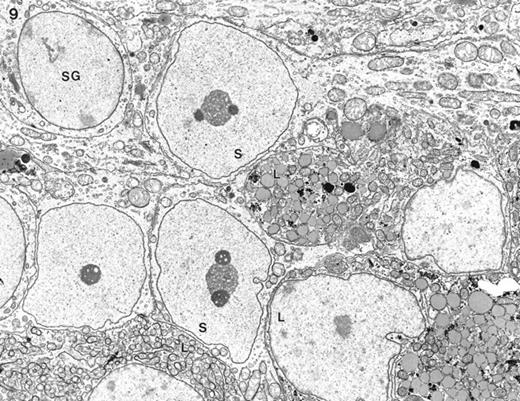 Electron micrograph of feminized Dhh-null testis of 20 days of age. At the periphery of some seminiferous tubules no peritubular tissue was seen, allowing direct contact between fetal-type Leydig cells (L) and Sertoli cells (S). SG, Spermatogonium. Magnification = ×3500