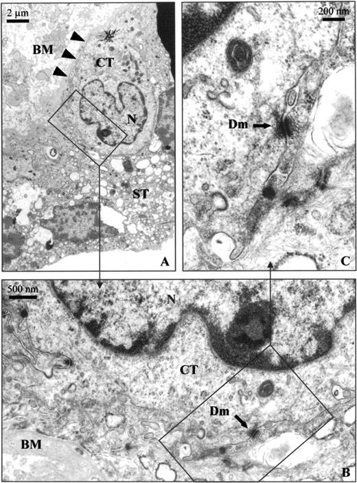Transmission electron micrographs of villous placental tissue. A) Thin section of villous mononuclear cytotrophoblast and multinucleated syncytiotrophoblast cells. B) Evidence of desmosome junctions between cytotrophoblast and syncytiotrophoblast cells. C) Intercellular junction with a desmosome structure. BM, Basal membrane (large arrows); CT, cytotrophoblast cell; ST, syncytiotrophoblast cell; N, nucleus; Dm, desmosome (small arrows)