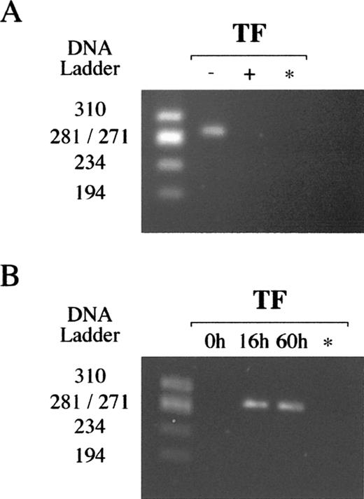 Detection of TF mRNA in villous trophoblast cells by RT-PCR. A) TF mRNA in villous cytotrophoblast cells freshly isolated from human term placentas using a digestion solution without (−) or with (+) 1 mM EDTA. B) TF mRNA in villous cytotrophoblast cells freshly isolated or in cells cultured for 16 and 60 h in complete medium. * Negative control; DNA ladder ΦX174 RF/HaeIII DNA ladder. Data representative of at least two independent experiments