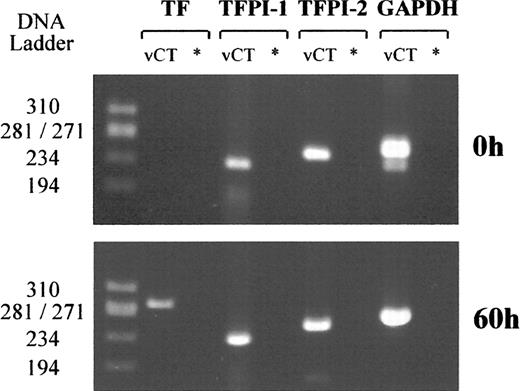 Detection of TF, TFPI-1, TFPI-2, and GAPDH mRNA. A) Villous cytotrophoblast cells freshly isolated from human term placentas. B) Cells cultured for 60 h in complete medium. * Negative control; DNA ladder ΦX174 RF/HaeIII DNA ladder. Data representative of five independent experiments