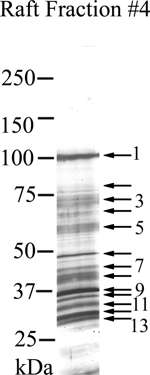 MS/MS analysis of lipid rafts. Proteins detected by silver stain in the light buoyant-density DRM fraction (fraction 4) of noncapacitated sperm were numbered, excised, and submitted for peptide analysis and protein identification as described in Materials and Methods. For simplicity, every other protein band is numbered, whereas every arrow represents an excised silver-stained band. The Sequest algorithmic program or manual EST database searches were used to match the peptides to known proteins. Proteins identified by this method are shown in Table 1