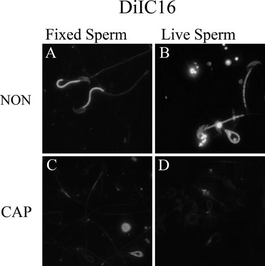 Detection of liquid-ordered plasma membrane domains in noncapacitated (NON) and capacitated (CAP) sperm with the lipid analog-probe DiIC16. Both NON (top; A and B) and CAP (bottom; C and D) sperm were labeled with the lipid analog-probe DiIC16 to detect liquid-ordered domains as described in Materials and Methods. Labeling with DiIC16 of fixed (left; A and C) and live (right; B and D) sperm was performed as described in Materials and Methods to compare probe binding of liquid-ordered domains in both conditions. Original magnification ×40