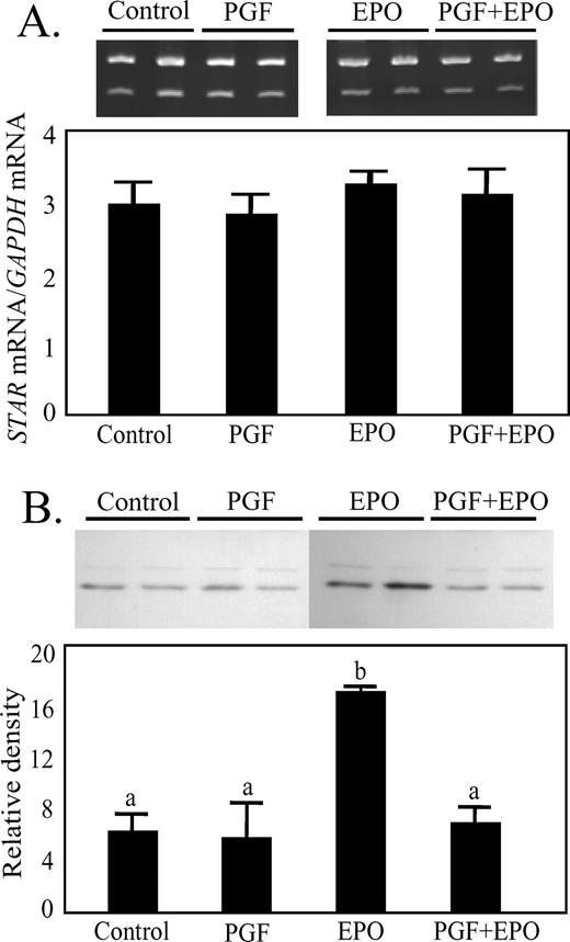 Effect of in vivo treatment with EPO for 48 h or PGF (10 h after treatment) on expression of STAR mRNA (A) or STAR protein (B) in luteal tissue. A) Representative ethidium bromide-stained gel, with GAPDH mRNA in the upper band and STAR mRNA in the lower band. The ratio of the two mRNAs is shown in the graph. B) Representative Western blot for STAR protein with a graph of the normalized results. Different lowercase letters indicate significant differences between groups (P < 0.05).