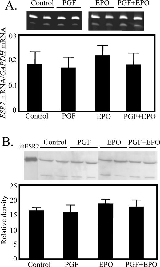 Lack of effect of in vivo treatment with EPO for 48 h or PGF (10 h after treatment) on expression of ESR2 mRNA (A) or ESR2 protein (B) in luteal tissue. A) Representative ethidium bromide-stained gel, with GAPDH mRNA in the upper band and ESR2 in the lower band. The ratio for all samples is shown in the graph. B) Representative Western blot for ESR2 protein.