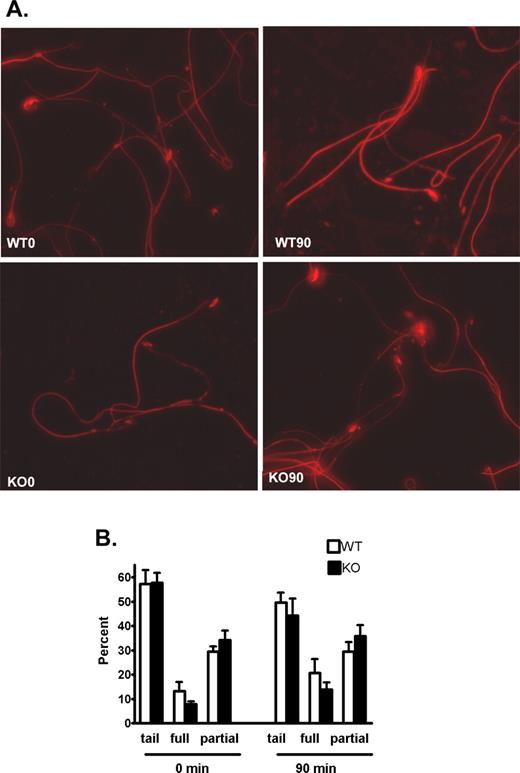 Phosphotyrosine fluorescence in capacitated Cst8+/+ and Cst8−/− spermatozoa. A) At 0 and 90 min of capacitation, Cst8+/+ (WT) and Cst8−/− (KO) spermatozoa were air-dried onto slides and incubated with the monoclonal anti-phosphotyrosine antibody followed by an Alexa Fluor 594-labeled secondary antibody. All images were captured using the same exposure times and were set to that of the strongest fluorescent labeling in WT 90-min sperm samples. Fluorescent images are superimposed on those obtained under phase contrast. Original magnification ×40. B) Percentage of spermatozoa that exhibited phosphotyrosine fluorescence on the midpiece and principle piece only (tail), tail plus full head fluorescence (full), or tail and partial head fluorescence (partial) at 0 and 90 min of capacitation. Value represent the mean ± SEM (n = 3 experiments).