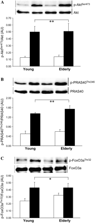 Phosphorylation of Akt, PRAS40, and FoxO3a in skeletal muscle of young and elderly women in response to fed-state clamp. (A) Phosphorylated AktSer473/total Akt (n = 6 young, n = 5 elderly). (B) Phosphorylated PRAS40Thr246/total PRAS40 (n = 5 young, n = 5 elderly). (C) Phophorylated FoxO3aThr32/FoxO3a (n = 6 young, n = 5 elderly). Graphs are mean ± SEM, with representative blots. Repeated measures analysis of variance: Clamp effect, **p < .001, *p < 0.05. No significant age effect or age-by-clamp interaction. AU: arbitrary densitometric units. White bars: postabsorptive; black bars: fed-state clamp.