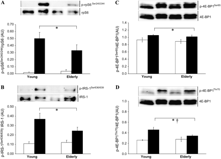 Phosphorylation of rpS6, IRS-1, and 4E-BP1 in skeletal muscle of young and elderly women in response to fed-state clamp. (A) Phosphorylated rpS6Ser240/244/total rpS6 (n = 5 young, n = 5 elderly). (B) Phosphorylated IRS-1Ser636/639/total IRS-1 (n = 5 young, n = 4 elderly). (C) Phosphorylated 4E-BP1Ser65 (n = 4 young, n = 4 elderly) and (D) phosphorylated 4E-BP1Ser70 (n = 5 young, n =5 elderly), both as ratio to total 4E-BP1. Graphs are mean ± SEM, with representative blots. Repeated measures analysis of variance: Clamp effect, **p = .001, *p < .05; †age-by-clamp interaction, p < .05; no significant age effect. AU: arbitrary densitometric units. White bars: postabsorptive; black bars: fed-state clamp.