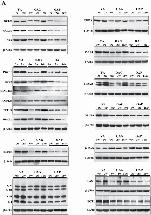 (A) Western blots for protein expression; each blot represents serial biopsies one participant from YA (0w, 2w), the OAG (0w, 2w, 16w), and OAP (0w, 2w, 16w). GCLC and GCLM = Glutamate cysteine ligase catalytic and modifier subunits; GSS = Glutathione synthetase; PGC1α = PPARG coactivator 1-alpha; SirT3 = Sirtuin 3; pAMPKα = phosphorylated AMP-activated protein kinase α subunit; AMPKα = total AMP-activated protein kinase α subunit; CPT1B = Carnitine palmitoyltransferase 1B; PPARα = Peroxisome proliferator-activated receptor α; HADHA = hydroxyacyl-CoA dehydrogenase trifunctional multienzyme complex subunit α; C-I, II, III, V = mitochondrial complexes I, II, II, V; ATP5A = mitochondrial ATP synthase F1 subunit alpha; PINK1 = PTEN-induced kinase 1; LC3AB = Microtuble-associated protein light chain 3 A and B; GLUT4 = Glucose transporter type 4; pH2AX = phospho-H2A histone family member X; PAX7 = Paired box protein 7; p16INK4α = p16; POT1 = Protection of telomeres protein 1. Additional details are in methods section. (B) Quantification of Immunoblots from 3 participants per group of YA, OAP and OAG. The figure shows average optical densities of protein expression from each group normalized to the loading control (β-actin). * = p < .05; ϕ = p < .01; θ = p < .001. GlyNAC = combination of glycine and N-acetylcysteine; YA = young adults; OAG = older adults receiving GlyNAC; OAP = older adults receiving placebo.