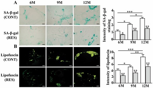 Effects of resveratrol on SA-β-gal activity and lipofuscin accumulation in the ovaries of 6-, 9-, and 12-month-old fish. (A) SA-β-gal staining and its quantification by Image J (n = 3 per group). (B) Lipofuscin accumulation and its quantification by Image J (n = 3 per group). 6M = 6-month-old; 9M = 9-month-old, 12M = 12-month-old. White: control (CONT); Gray: resveratrol (RES). Scale bar = 50 μm. The values are shown as the mean ± SD. *p < .05, **p < .01, ***p < .001.