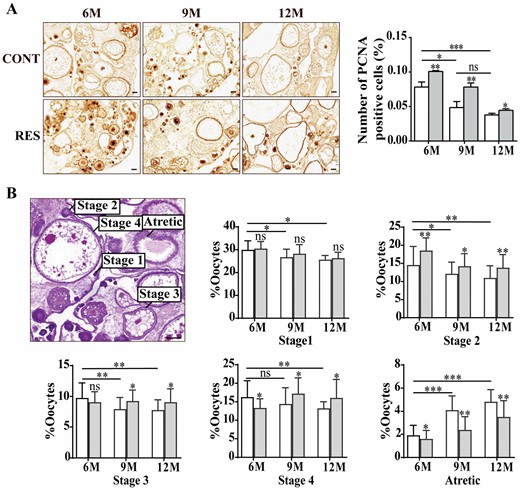 Effects of resveratrol on cell proliferation and ovarian reserve at different ages. (A) Staining of PCNA detected by immunohistochemistry and its quantitation in ovaries of the fish at 6-, 9-, and 12-month old (n = 3 per group). Scale bar = 50 μm. (B) Developmental stages and quantification of the oocytes in the ovaries of 6-, 9-, and 12-month-old fish (n = 5 per group). Stage 1, oogonium; Stage 2, primary growth stage; Stage 3, cortical alveolus stage; Stage 4, vitellogenesis stage; Atretic, atretic stage. Scale bar = 100 μm. 6M = 6-month-old; 9M = 9-month-old; 12M = 12-month-old. White: control (CONT); Gray: resveratrol (RES). The values are shown as the mean ± SD.
*p < .05, **p < .01, ***p < .001, ns: no significance.