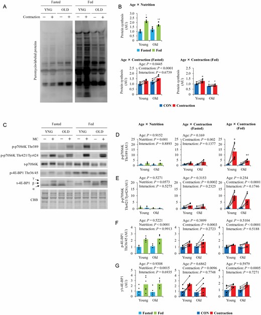 The influence of aging on nutrition- and contraction-induced muscle protein synthesis and mTORC1 activation. (A) Representative blot image of puromycin-labeled nascent polypeptide. (B) Quantitative values of muscle protein synthesis. (C) Representative blot image of mTORC1 substrates. (D–G) Quantitative values of mTORC1 substrates. Values are expressed by MEANS and individual values using bar–dot plot (n = 6 per condition). +p < .05 versus fasted. *p < .05 versus CON. #p < .05 versus similar condition in young.