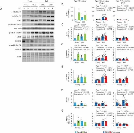 The influence of aging, nutrition, and contraction on upstream regulators of mTOR. (A) Representative blot image of upstream regulators of mTOR. (B–F) Quantitative values of upstream regulators of mTOR. Values are expressed by MEANS and individual values using bar–dot plot (n = 6 per condition). +p < .05 versus fasted. #p < .05 versus similar condition in young.