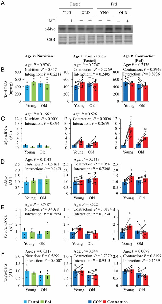 The influence of aging, nutrition, and contraction on ribosome content and expression of upstream regulators of ribosome biogenesis. (A) Representative blot image. (B–F) Quantitative values of total RNA and upstream regulators of ribosome biogenesis. Values are expressed by MEANS and individual values using bar–dot plot (n = 6 per condition). *p < .05 versus CON. #p < .05 versus similar condition in young.