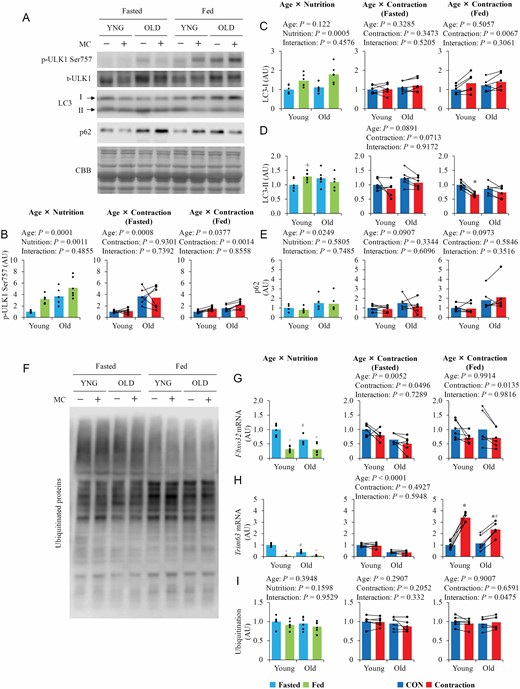 The influence of aging, nutrition, and contraction on the regulators of autophagy–lysosome and ubiquitin–proteasome system. (A) Representative blot images of autophagy–lysosome system regulators. (B–E) Quantitative values of autophagy–lysosome system regulators. (F) Representative blot images of ubiquitinated protein. (G–I) Quantitative values of ubiquitin–proteasome system regulators. Values are expressed by MEANS and individual values using bar–dot plot (n = 6 per condition). +p < .05 versus fasted. *p < .05 versus fasted/CON. #p < .05 versus similar condition in young.