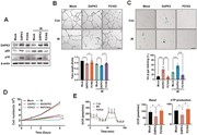 DAPK3 overexpression induces cellular senescence. ( A ) Human brain microva...